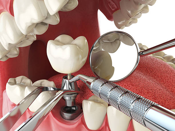 Best Emergency Dental Care for Broken or Chipped Teeth in Haymarket, VA