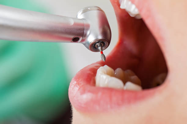 Best Urgent Care for Lost Fillings or Crowns in Haymarket, VA
